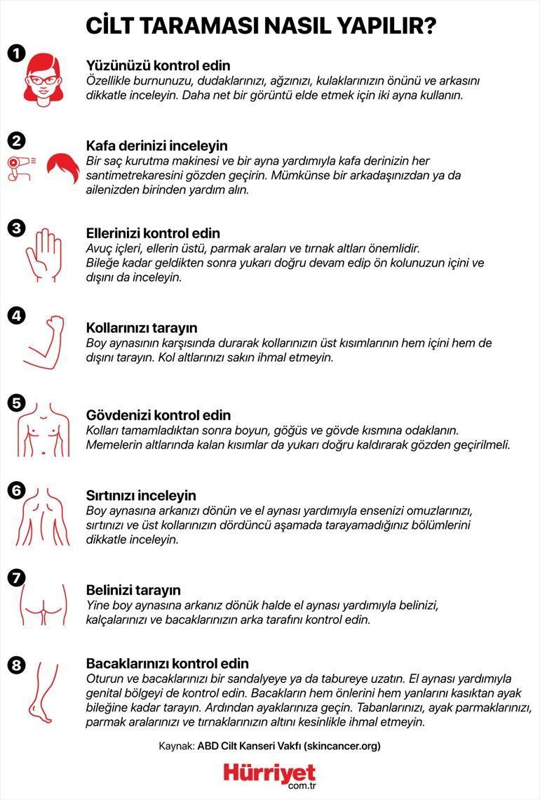 Arkadaşının dikkati sayesinde kanser olduğunu öğrendi, kolunun bir kısmı alındı | Hangi benler radarımızda olmalı