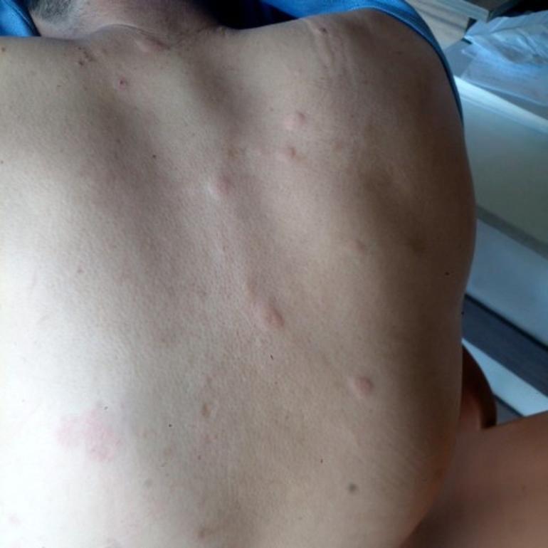 Duyduğu seslere giden çiftçi hayatının şokunu yaşadı Ayı saldırısından kurtuldum derken dehşeti yaşadı