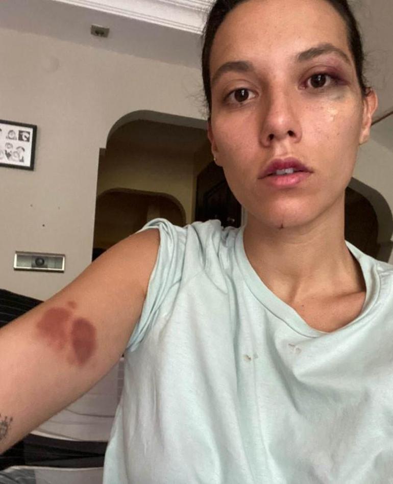 Deniz Bulutsuz ceza sevincini paylaştı Cezaevine gireceği günü bekliyorum