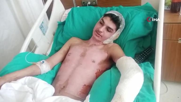Amcası tarafından benzin dökülerek yakılmıştı Dehşet anlarının görüntüsü ortaya çıktı