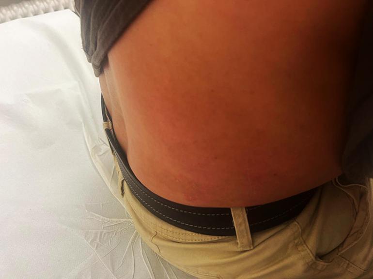 Saldırıya uğrayan Yorulmaz ailesi: Polisler, saldırganı korudu, bizi azarladı