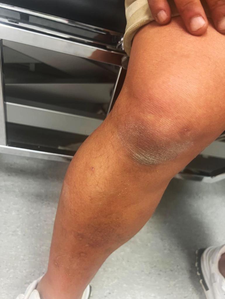 Saldırıya uğrayan Yorulmaz ailesi: Polisler, saldırganı korudu, bizi azarladı