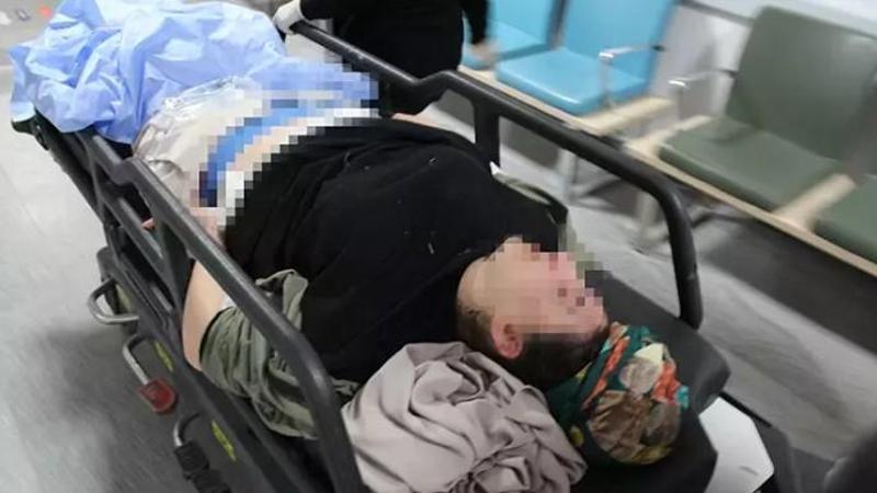 Parkta cebindeki tabancayı çıkarırken kendini vurdu, yaralı olarak hastaneye kaldırıldı