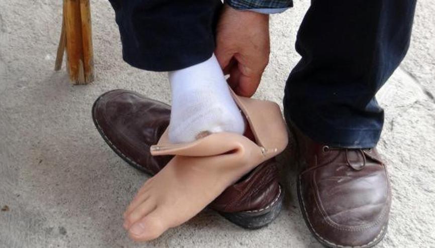 Protezine haciz gelen Gaziye, şimdi de yardıma muhtaçlık şartı