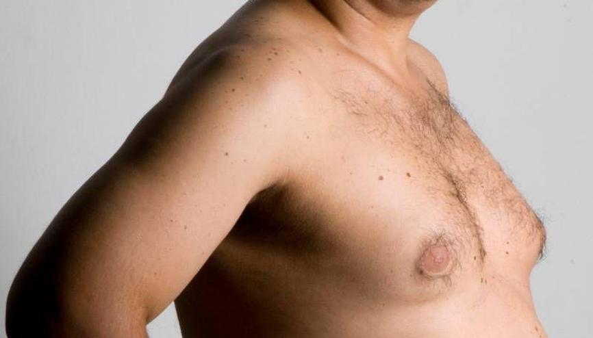 Male breast