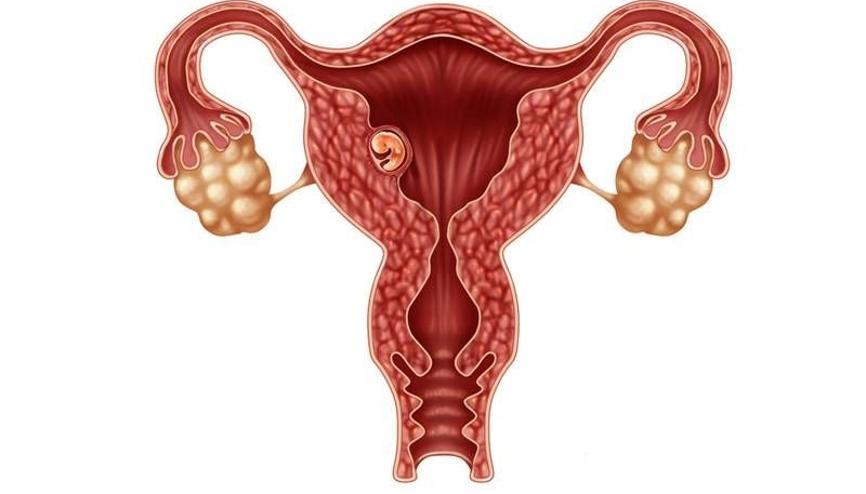 Rahim transferi nedir Rahim transferi nasıl yapılır