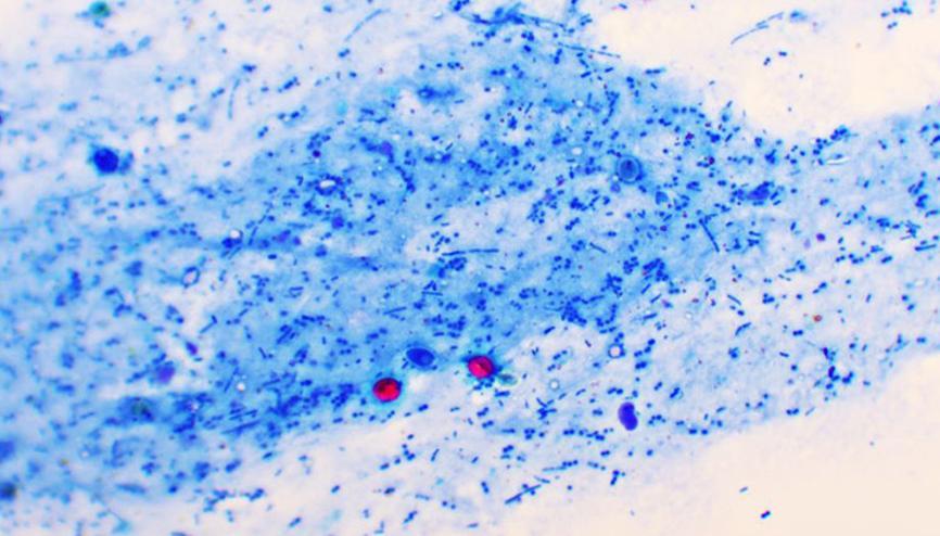 İngiltere’de su kaynaklı hastalıklar artıyor Vaka sayısı 46ya yükseldi...