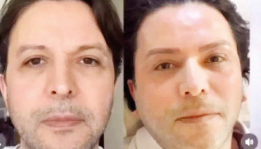 Son hali gündem oldu: Nihat yeni doğan