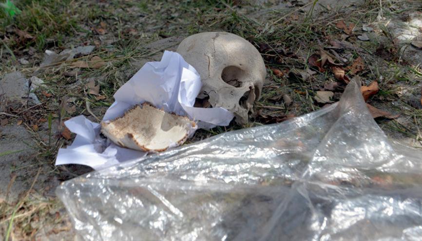 Adanada çöpten kağıda sarılı kafatası çıktı Soruşturma başlatıldı... Bir çocuğa ait olduğu değerlendiriliyor Adanada çöpten kağıda sarılı kafatası çıktı Soruşturma başlatıldı... Bir çocuğa ait olduğu değerlendiriliyor