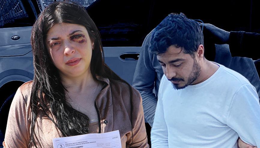 Genç kadın duruşmada fenalık geçirdi Damlayı yol ortasında dövüp taciz etmişti... Akıllara durgunluk veren savunma Genç kadın duruşmada fenalık geçirdi Damlayı yol ortasında dövüp taciz etmişti... Akıllara durgunluk veren savunma