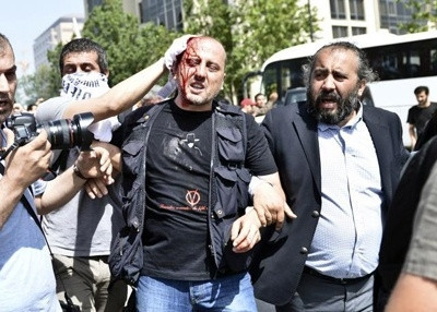 Ahmet Şık Gezi eyleminde yaralandı