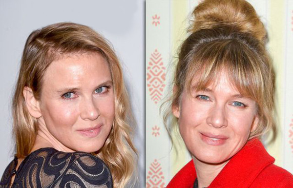 Renee Zellweger eski haline dönmeye başladı