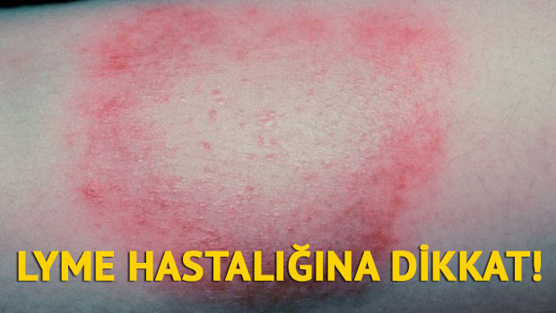 Avril Lavigne: Öleceğim sandım