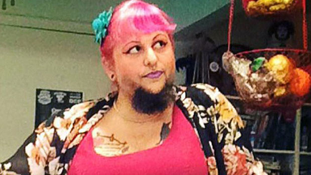 Hastalığı yüzünden sakalları var