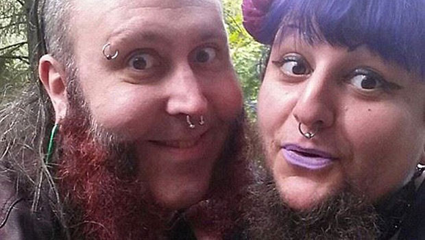 Hastalığı yüzünden sakalları var