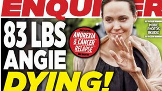 Angelina Jolie mum gibi eridi, artık kemikleri sayılıyor