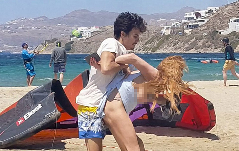Sevgilisi tarafından tartaklanan ünlü oyuncu çılgına döndü