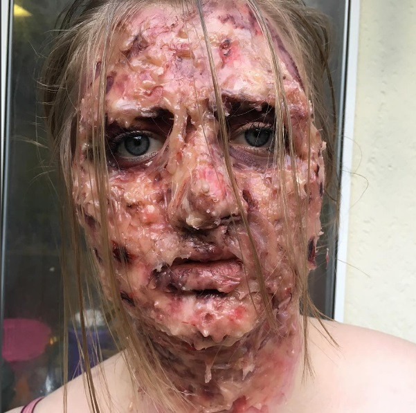 Genç kadını görenler dehşete düşüyor Genç kadını görenler dehşete düşüyor