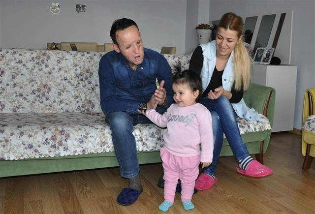 Yüz nakli olan Recep Sert’in son hali