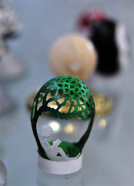 Kaza geçirince bu işe başladı...