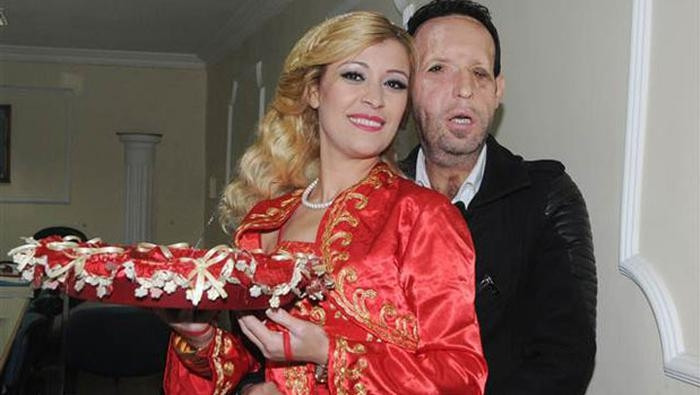 Recep Sertin başı dertte Recep Sertin başı dertte
