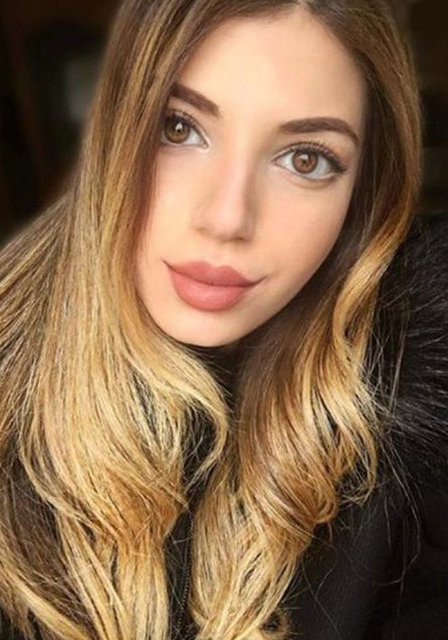 Lidya Özdemiroğlu dudaklarındaki dolguyu eritti