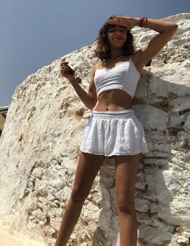 Lidya Özdemiroğlu dudaklarındaki dolguyu eritti