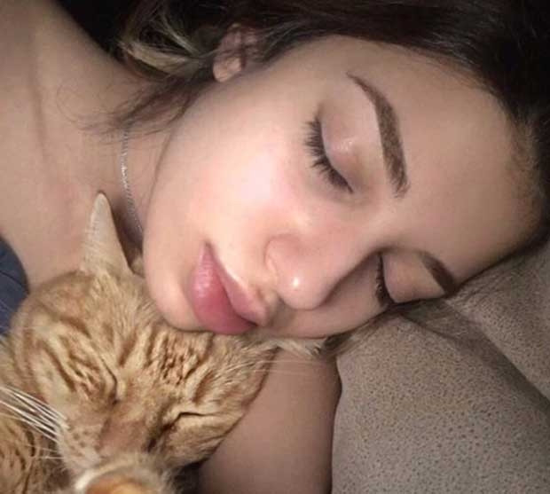 Lidya Özdemiroğlu dudaklarındaki dolguyu eritti