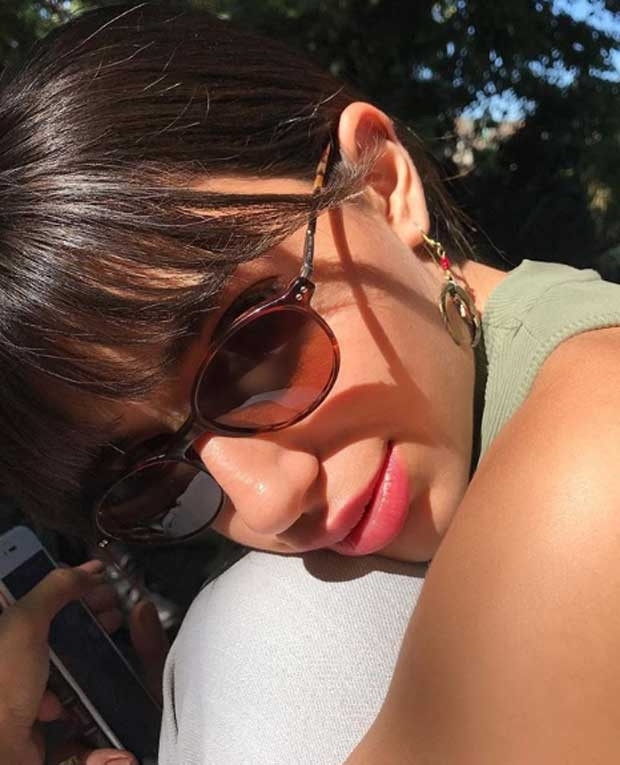 Lidya Özdemiroğlu dudaklarındaki dolguyu eritti