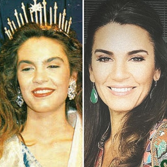 Kardeşimin o kadar eksiği vardı ki, estetik yaptırmam haksızlık olur