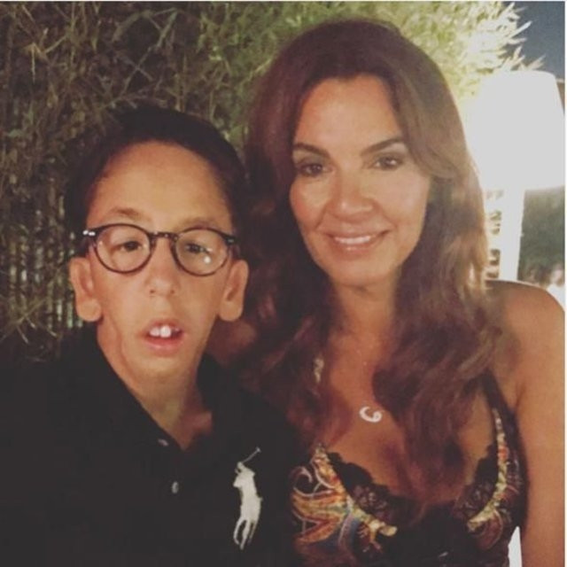 Kardeşimin o kadar eksiği vardı ki, estetik yaptırmam haksızlık olur