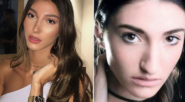 Türkiye Güzeli Şevval Şahinden estetik itirafı