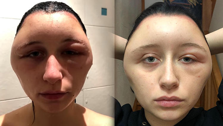 Aman dikkat Ufacık bir hata tanınmaz hale getirdi