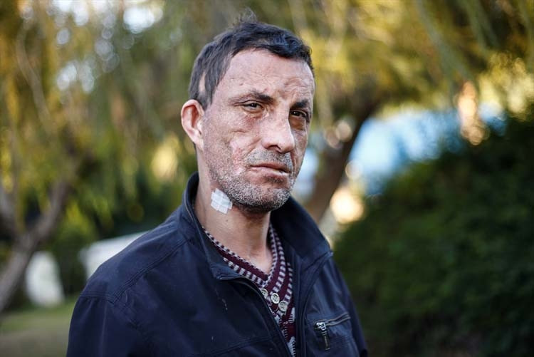 Aradan tam 7 yıl geçti İşte Uğur Acar’ın son hali…