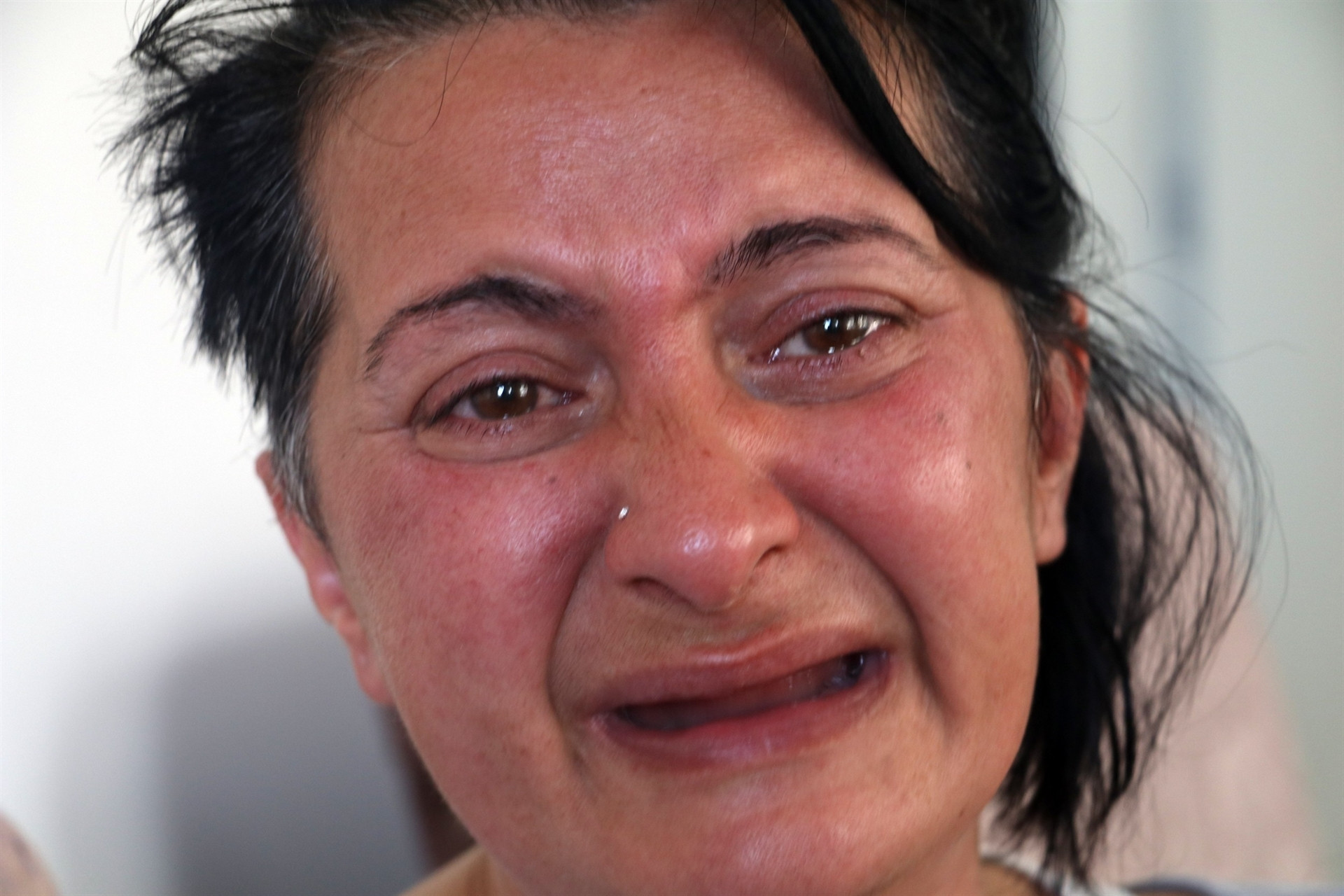 Ağlayarak ötenazi isteyen acılı kadın aylar sonra ilk kez gülebildi