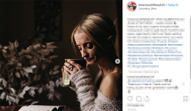 50 milyonda bir rastlanan hastalık yüzünden herkesten sekiz kat hızlı yaşlanıyor