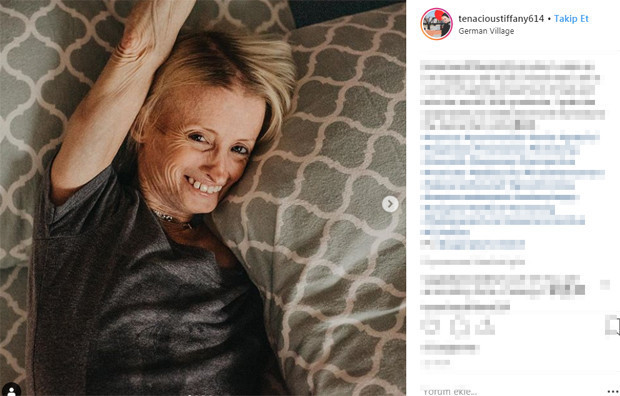 50 milyonda bir rastlanan hastalık yüzünden herkesten sekiz kat hızlı yaşlanıyor