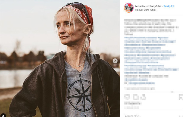 50 milyonda bir rastlanan hastalık yüzünden herkesten sekiz kat hızlı yaşlanıyor