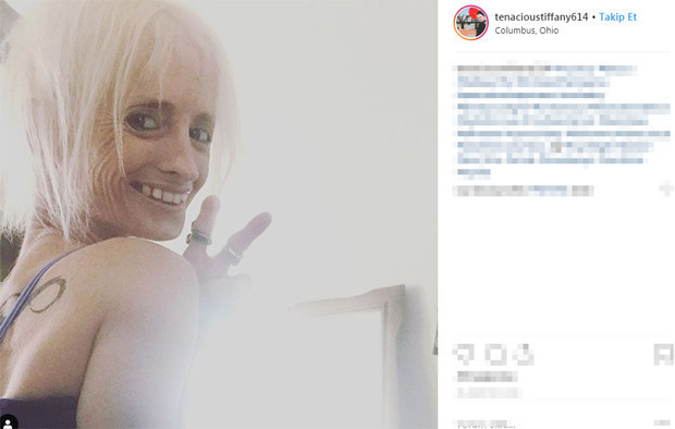 50 milyonda bir rastlanan hastalık yüzünden herkesten sekiz kat hızlı yaşlanıyor