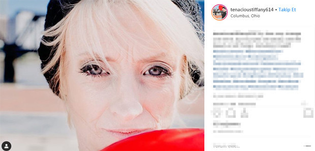 50 milyonda bir rastlanan hastalık yüzünden herkesten sekiz kat hızlı yaşlanıyor