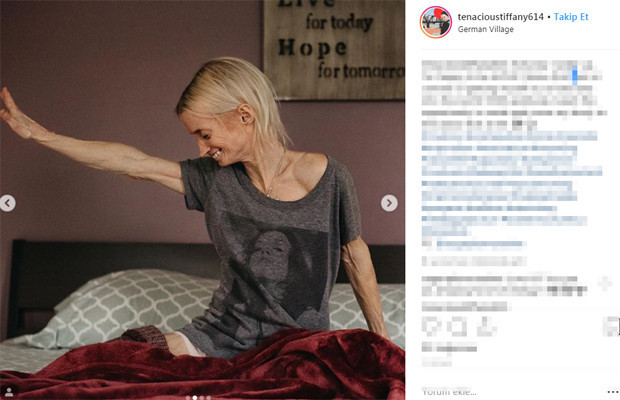 50 milyonda bir rastlanan hastalık yüzünden herkesten sekiz kat hızlı yaşlanıyor