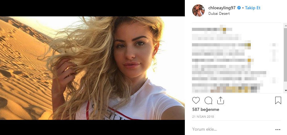 Kaçırılıp işkence gördü Tek tek anlatacak