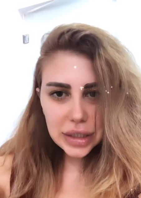 Melis Buse Betkayanın estetikli hali şaşırttı