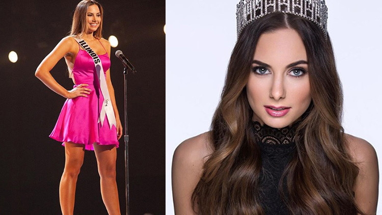 Ünlü model kanser atlattı Şans eseri öğrenmişti Ünlü model kanser atlattı Şans eseri öğrenmişti