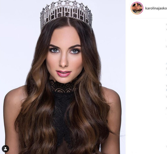 Ünlü model kanser atlattı Şans eseri öğrenmişti Ünlü model kanser atlattı Şans eseri öğrenmişti