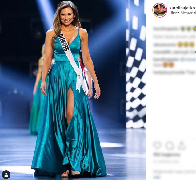 Ünlü model kanser atlattı Şans eseri öğrenmişti Ünlü model kanser atlattı Şans eseri öğrenmişti