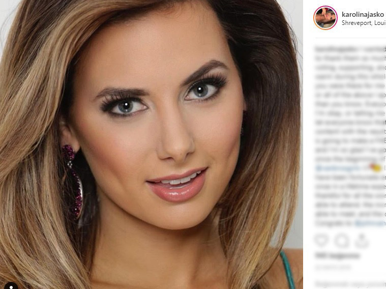 Ünlü model kanser atlattı Şans eseri öğrenmişti Ünlü model kanser atlattı Şans eseri öğrenmişti