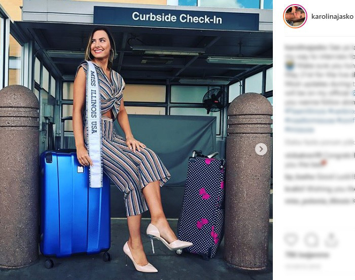 Ünlü model kanser atlattı Şans eseri öğrenmişti Ünlü model kanser atlattı Şans eseri öğrenmişti