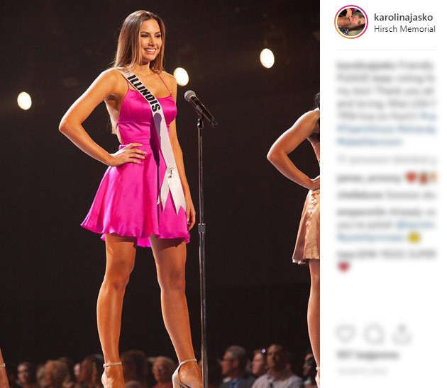 Ünlü model kanser atlattı Şans eseri öğrenmişti Ünlü model kanser atlattı Şans eseri öğrenmişti