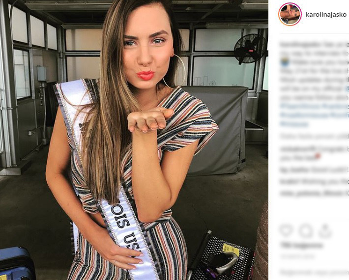 Ünlü model kanser atlattı Şans eseri öğrenmişti Ünlü model kanser atlattı Şans eseri öğrenmişti